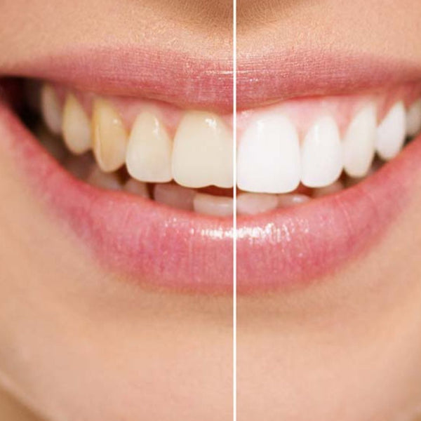 Healthier Gums